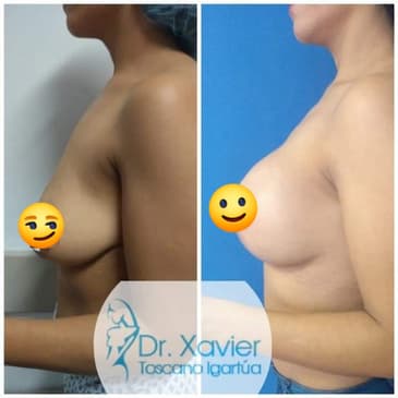 Slider image (2) Dr. Xavier Toscano - Plastic Surgeon